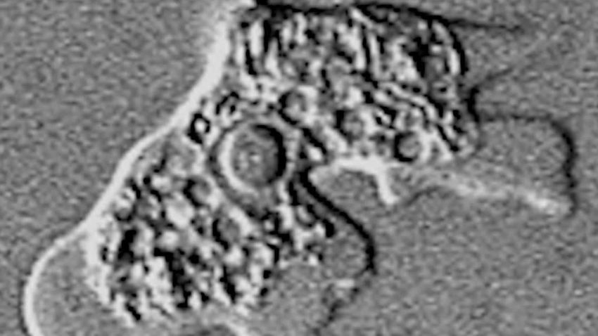 Georgia resident dies from rare brain-eating amoeba, health officials say .